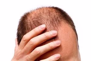بهترین شامپو تقویت کننده مو